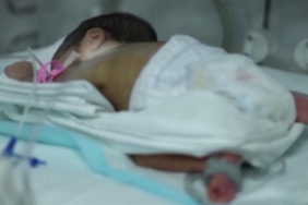 Erken Doğum Hikayeleri ve Türkiye’de Prematüreyle Yaşam: Gelişmeler ve Ailelerin Deneyimleri 4 erken-dogum-hikayeleri-ve-turkiyede-prematureyle-yasam-gelismeler-ve-ailelerin-deneyimleri-fkBjGPfH.jpg