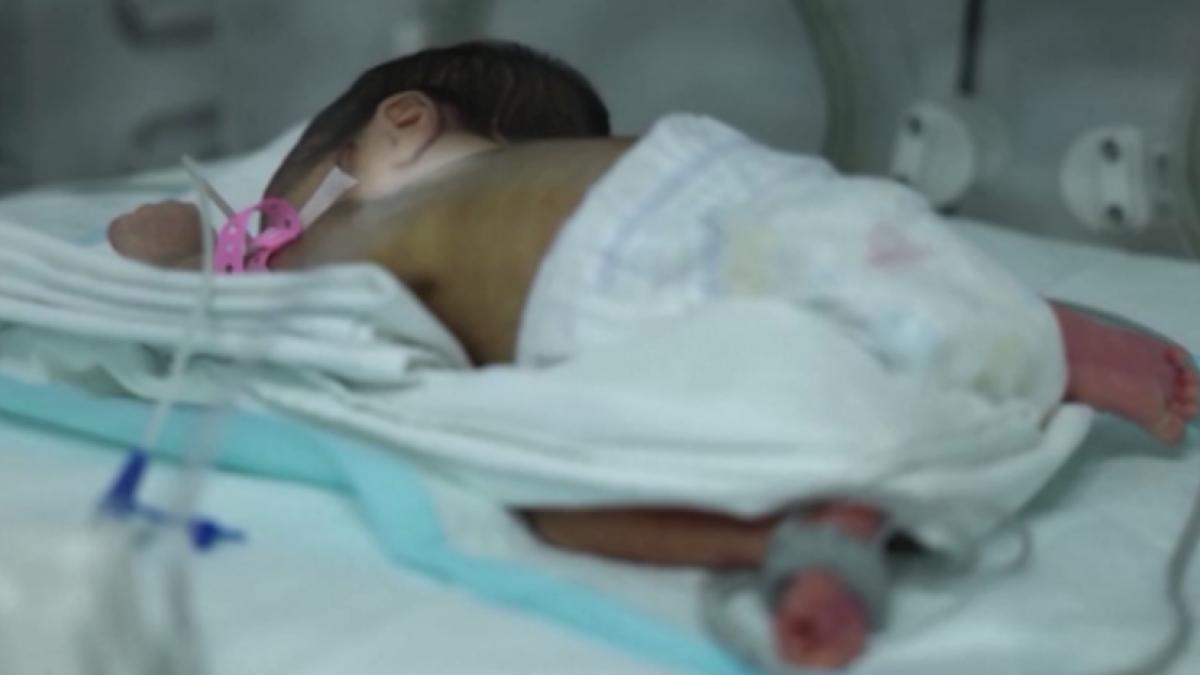 Erken Doğum Hikayeleri ve Türkiye’de Prematüreyle Yaşam: Gelişmeler ve Ailelerin Deneyimleri 2 erken-dogum-hikayeleri-ve-turkiyede-prematureyle-yasam-gelismeler-ve-ailelerin-deneyimleri-fkBjGPfH.jpg