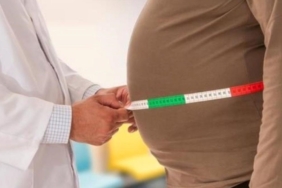 Sağlık Bakanlığı Obezite Tedavisi ve Tanıtım Yönetmeliklerinde Yeni Dönem Başlattı 6 saglik-bakanligi-obezite-tedavisi-ve-tanitim-yonetmeliklerinde-yeni-donem-baslatti-mGwgdyEf.jpg