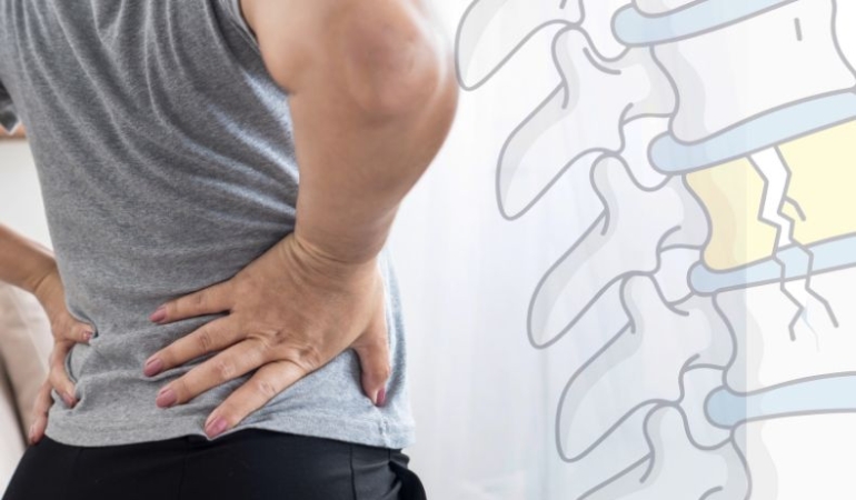 Belde Ağrının Sebebi Ne Olabilir? 6 bel-agirisi