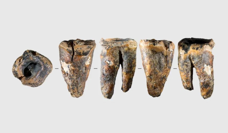 59 Bin Yıllık Diş Keşfi Neandertaller Hakkındaki Tüm Bildiklerimizi Değiştirdi 1 59-bin-yillik-dis-kesfi-neandertaller-hakkindaki-tum-bildiklerimizi-degistirdi-ACKwWItb.jpg