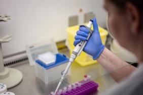 Hantavirüs Konusunda Türkiye’nin İzlediği Yaklaşım ve Sağlık Sisteminin Güçlü Yapısı 2 hantavirus-konusunda-turkiyenin-izledigi-yaklasim-ve-saglik-sisteminin-guclu-yapisi-46quwV8T.jpg