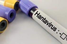 Hantavirüs Uyarısı Kapalı ve Tozlu Alanlarda Enfeksiyon Riski Artıyor 5 hantavirus-uyarisi-kapali-ve-tozlu-alanlarda-enfeksiyon-riski-artiyor-NAfTM7jX.jpg