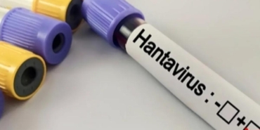 Hantavirüs Uyarısı Kapalı ve Tozlu Alanlarda Enfeksiyon Riski Artıyor 10 hantavirus-uyarisi-kapali-ve-tozlu-alanlarda-enfeksiyon-riski-artiyor-NAfTM7jX.jpg