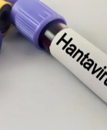 Hantavirüs Uyarısı Kapalı ve Tozlu Alanlarda Enfeksiyon Riski Artıyor 10 hantavirus-uyarisi-kapali-ve-tozlu-alanlarda-enfeksiyon-riski-artiyor-NAfTM7jX.jpg