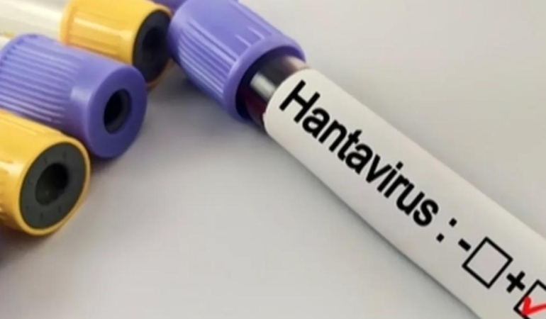 Hantavirüs Uyarısı Kapalı ve Tozlu Alanlarda Enfeksiyon Riski Artıyor 6 hantavirus-uyarisi-kapali-ve-tozlu-alanlarda-enfeksiyon-riski-artiyor-NAfTM7jX.jpg