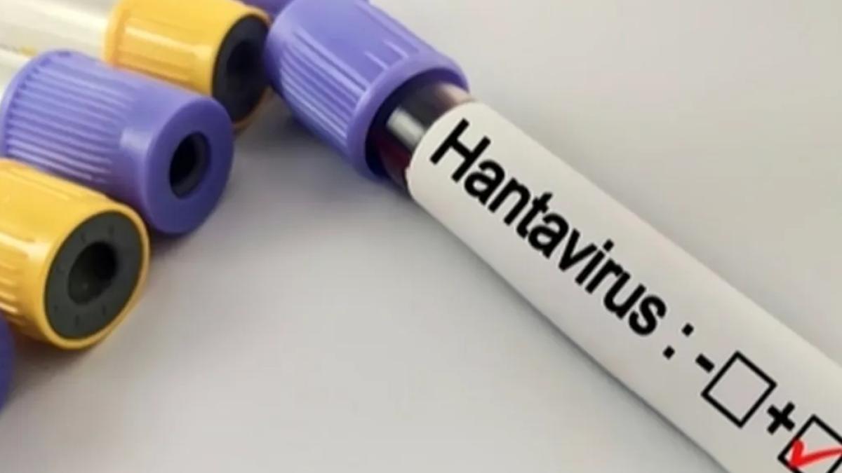 Hantavirüs Uyarısı Kapalı ve Tozlu Alanlarda Enfeksiyon Riski Artıyor 2 hantavirus-uyarisi-kapali-ve-tozlu-alanlarda-enfeksiyon-riski-artiyor-NAfTM7jX.jpg