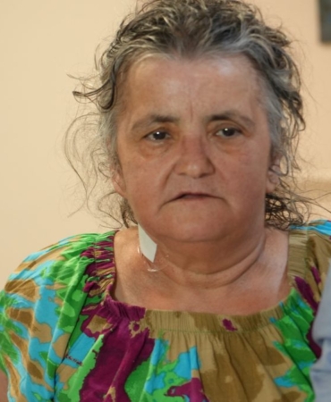 Göbek Fıtığında Acil Müdahale ve Uzun Operatif Süreç: Nihal Uygun’un Hikayesi 4 gobek-fitiginda-acil-mudahale-ve-uzun-operatif-surec-nihal-uygunun-hikayesi-dbhpzgDz.jpg